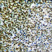 Anti-phospho-SEK1/MKK4 (pThr261) antibody produced in rabbit affinity isolated antibody