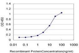 Monoclonal Anti-DSCR1 antibody produced in mouse clone 1B1, purified immunoglobulin, buffered aqueous solution