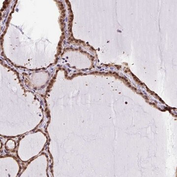 Anti-SGTA antibody produced in rabbit Prestige Antibodies&#174; Powered by Atlas Antibodies, affinity isolated antibody, buffered aqueous glycerol solution