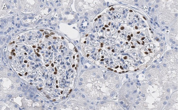 Anti-Wilms Tumor Protein Antibody, clone 2O18 ZooMAb&#174; Rabbit Monoclonal recombinant, expressed in HEK 293 cells