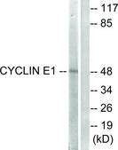 Anti-Cyclin E1 antibody produced in rabbit affinity isolated antibody
