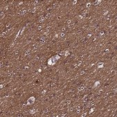 Anti-NSMF antibody produced in rabbit Prestige Antibodies® Powered by Atlas Antibodies, affinity isolated antibody, buffered aqueous glycerol solution