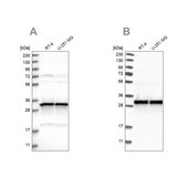 Anti-MRPL45 antibody produced in rabbit Prestige Antibodies® Powered by Atlas Antibodies, affinity isolated antibody, buffered aqueous glycerol solution, Ab2