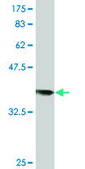 Monoclonal Anti-RAD18 antibody produced in mouse clone 2B9, purified immunoglobulin, buffered aqueous solution