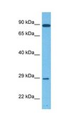 Anti-TIPARP antibody produced in rabbit affinity isolated antibody