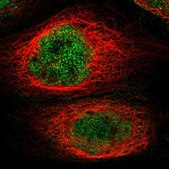 Anti-KCTD10 antibody produced in rabbit Prestige Antibodies® Powered by Atlas Antibodies, affinity isolated antibody, buffered aqueous glycerol solution