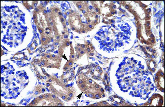 Anti-FABP3 antibody produced in rabbit IgG fraction of antiserum