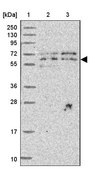 Anti-UTP18 antibody produced in rabbit Prestige Antibodies® Powered by Atlas Antibodies, affinity isolated antibody, buffered aqueous glycerol solution