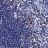 Anti-KIF2C antibody produced in rabbit Prestige Antibodies® Powered by Atlas Antibodies, affinity isolated antibody, buffered aqueous glycerol solution