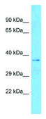 Anti-MARCH5, (N-terminal) antibody produced in rabbit affinity isolated antibody