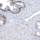 Anti-RXFP1 antibody produced in rabbit Prestige Antibodies® Powered by Atlas Antibodies, affinity isolated antibody, buffered aqueous glycerol solution