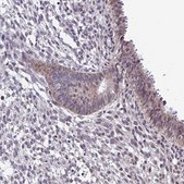 Anti-CARS2 antibody produced in rabbit Prestige Antibodies® Powered by Atlas Antibodies, affinity isolated antibody, buffered aqueous glycerol solution