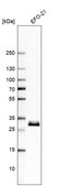 Anti-TMED1 antibody produced in rabbit Prestige Antibodies® Powered by Atlas Antibodies, affinity isolated antibody, buffered aqueous glycerol solution