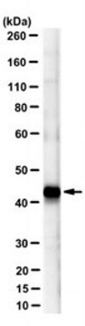 Anti-&#946;-Dystroglycan Antibody, clone 7D11