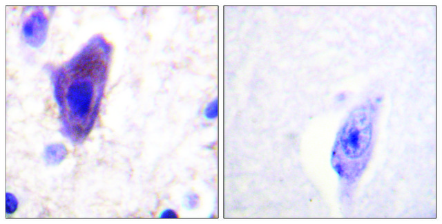 Anti-CD71 antibody produced in rabbit affinity isolated antibody