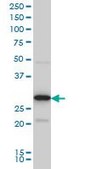 Monoclonal Anti-EXOSC3 antibody produced in mouse clone 5C3, purified immunoglobulin, buffered aqueous solution
