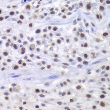 Anti-KAT1/HAT1 antibody produced in rabbit