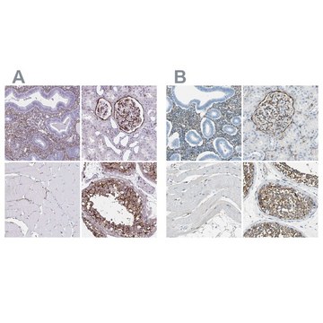 Anti-AKAP12 antibody produced in rabbit Prestige Antibodies&#174; Powered by Atlas Antibodies, affinity isolated antibody, buffered aqueous glycerol solution