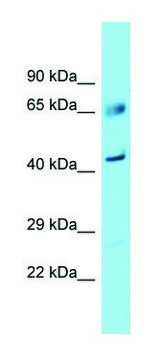 Anti-FAM83A (C-terminal) antibody produced in rabbit affinity isolated antibody