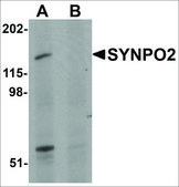Anti-SYNPO2 antibody produced in rabbit affinity isolated antibody, buffered aqueous solution