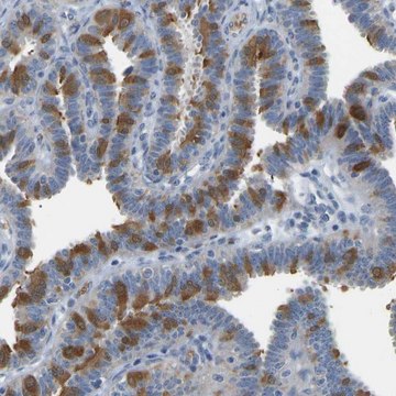 Anti-C21orf59 antibody produced in rabbit Prestige Antibodies&#174; Powered by Atlas Antibodies, affinity isolated antibody, buffered aqueous glycerol solution, Ab2