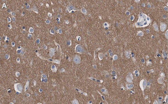 Anti-CD56 Antibody, clone 3F5 ZooMAb&#174; Rabbit Monoclonal recombinant, expressed in HEK 293 cells