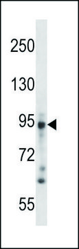 ANTI-DSG3 (N-TERM) antibody produced in rabbit IgG fraction of antiserum, buffered aqueous solution