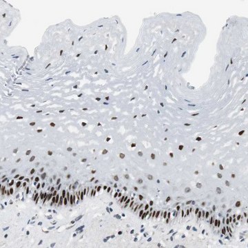 Anti-AJUBA antibody produced in rabbit Prestige Antibodies&#174; Powered by Atlas Antibodies, affinity isolated antibody, buffered aqueous glycerol solution