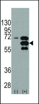 ANTI-INA (ALPHA INTERNEXIN) (CENTER) antibody produced in rabbit IgG fraction of antiserum, buffered aqueous solution