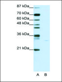 Anti-PDCD8 (AB1) antibody produced in rabbit affinity isolated antibody