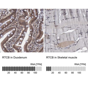 Anti-RTCB antibody produced in rabbit Prestige Antibodies® Powered by Atlas Antibodies, affinity isolated antibody, buffered aqueous glycerol solution