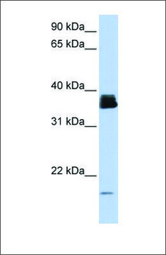 Anti-PPIA antibody produced in rabbit affinity isolated antibody