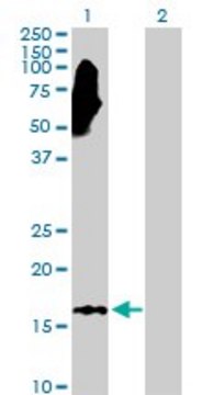 Anti-NME3 antibody produced in rabbit purified immunoglobulin, buffered aqueous solution