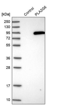 Anti-PLA2G6 antibody produced in rabbit Prestige Antibodies&#174; Powered by Atlas Antibodies, affinity isolated antibody, buffered aqueous glycerol solution