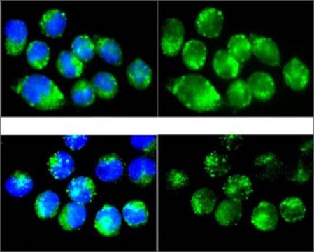 Anti-CAT antibody produced in rabbit affinity isolated antibody