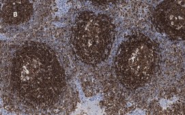 Anti-CD45 Antibody, clone 5L3, ZooMAb® Rabbit Monoclonal recombinant, expressed in HEK 293 cells