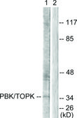 Anti-PBK antibody produced in rabbit affinity isolated antibody