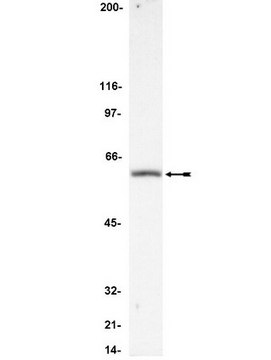 Anti-FLIP Antibody, CT Upstate&#174;, from rabbit