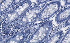 Anti-FBXO38 Antibody, clone 1I18 ZooMAb® Rabbit Monoclonal recombinant, expressed in HEK 293 cells