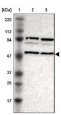 Anti-SNX4 antibody produced in rabbit Prestige Antibodies® Powered by Atlas Antibodies, affinity isolated antibody, buffered aqueous glycerol solution