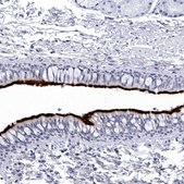 Anti-CCDC181 antibody produced in rabbit Prestige Antibodies® Powered by Atlas Antibodies, affinity isolated antibody, buffered aqueous glycerol solution, ab1
