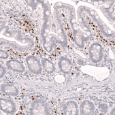 Monoclonal Anti-Irf4 Antibody Produced In Mouse Prestige Antibodies® Powered by Atlas Antibodies, clone CL14615, affinity isolated antibody, buffered aqueous glycerol solution