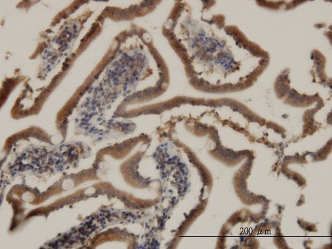 Monoclonal Anti-CIDEB antibody produced in mouse clone 2A10, purified immunoglobulin, buffered aqueous solution