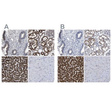 抗-AASS 兔抗 Prestige Antibodies&#174; Powered by Atlas Antibodies, affinity isolated antibody, buffered aqueous glycerol solution, Ab2