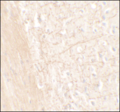 Anti-ERAP1 antibody produced in rabbit affinity isolated antibody