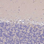 Anti-CFHR1 antibody produced in rabbit Prestige Antibodies® Powered by Atlas Antibodies, affinity isolated antibody, buffered aqueous glycerol solution