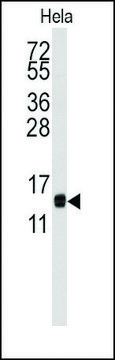 Anti-CDA (center) antibody produced in rabbit saturated ammonium sulfate (SAS) precipitated, buffered aqueous solution