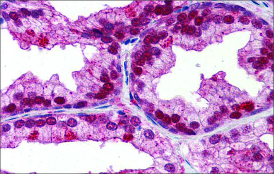 Anti-NFIX antibody produced in rabbit affinity isolated antibody