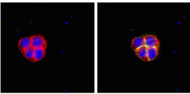 RIPAb+ Fragile X Mental Retardation Protein - RIP Validated Antibody and Primer Set from mouse