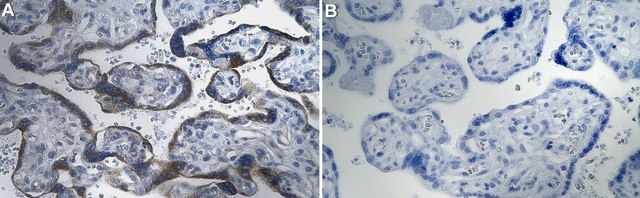 Anti-GDF15/NAG-1 Antibody, clone 1K11 ZooMAb&#174; Rabbit Monoclonal recombinant, expressed in HEK 293 cells